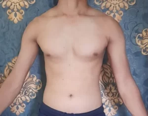 Weight loss